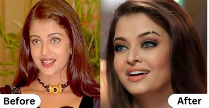 Aishwarya Rai Plastic Surgery: The Truth Behind Her Transformation
