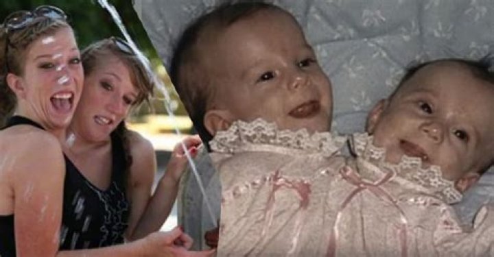Are Abby and Brittany Hensel Still Alive? Exploring the Lives of Conjoined Twins