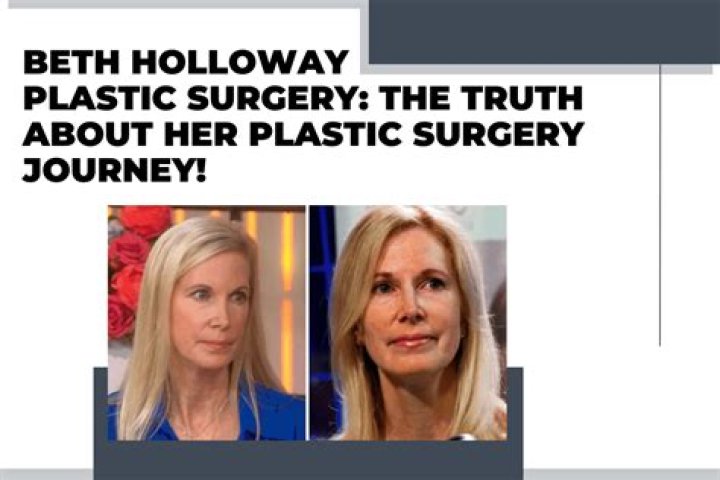 Bianca Censوري: Unveiling the Truth Behind Her Plastic Surgery Journey