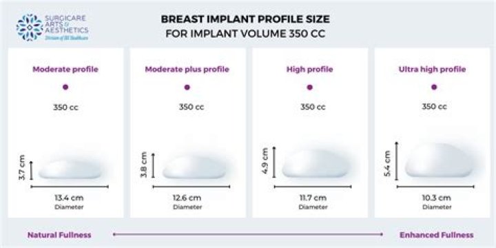 Bianca Censori Breast Augmentation: A Comprehensive Guide