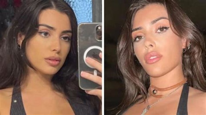 Bianca Censori Implants: A Comprehensive Guide to Understanding Her Journey