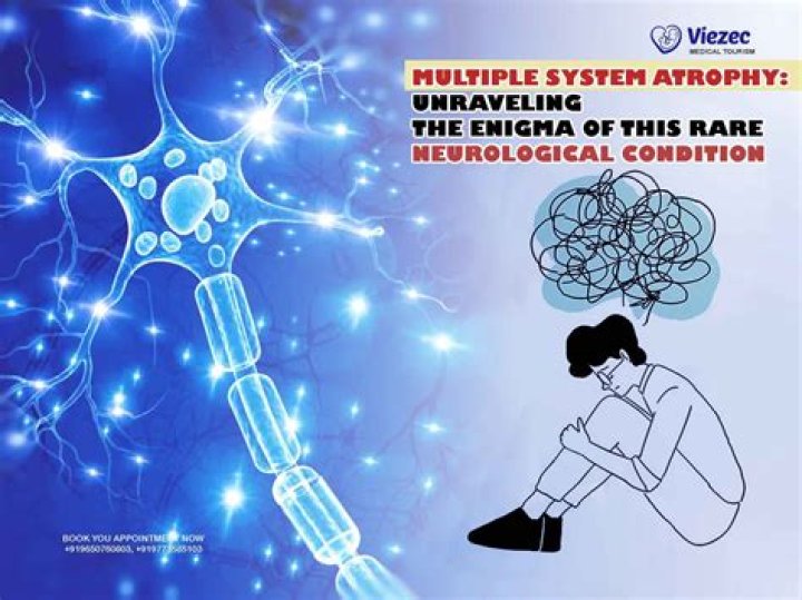 Brialexia: Understanding the Rare Neurological Condition