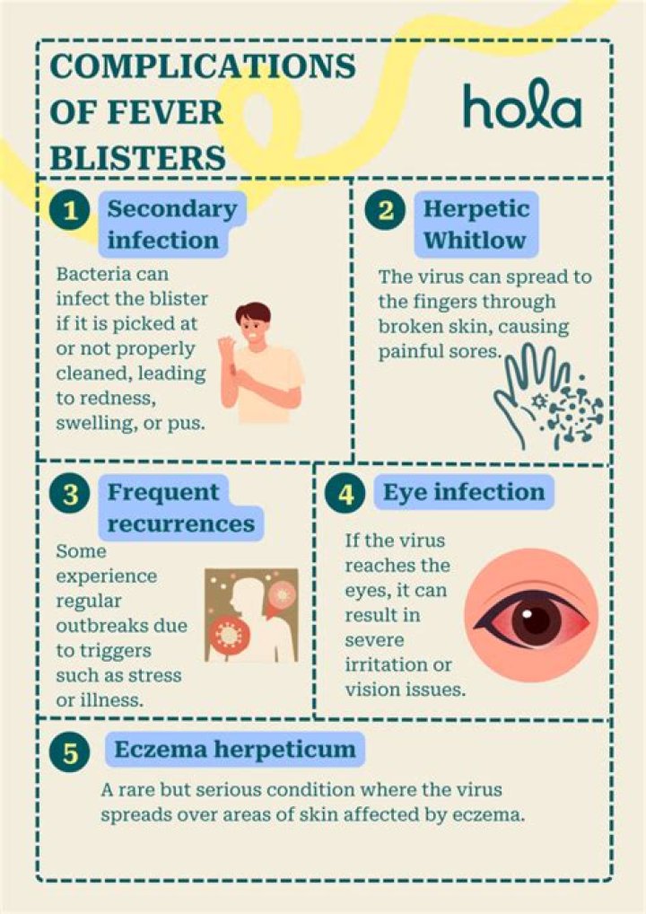Can I Pop a Fever Blister? Everything You Need to Know