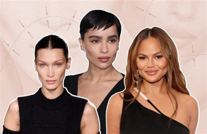 Celebrity Buccal Fat: The Ultimate Guide to Understanding the Trend