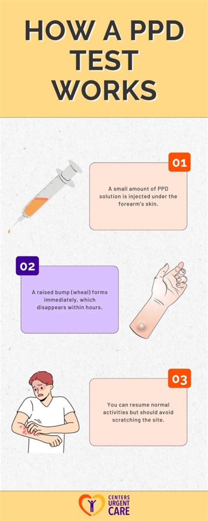 Comprehensive Guide to PPD Test in Philadelphia: Everything You Need to Know