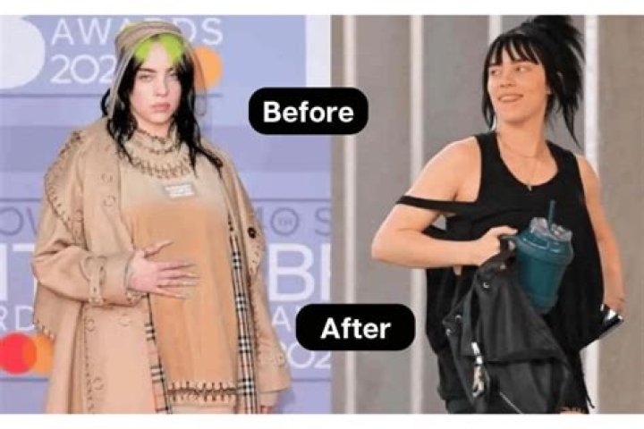 Did Billie Eilish Get Breast Reduction? The Truth Behind the Rumors
