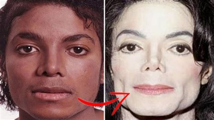 Did Michael Jackson Change His Skin Colour? Unveiling the Truth