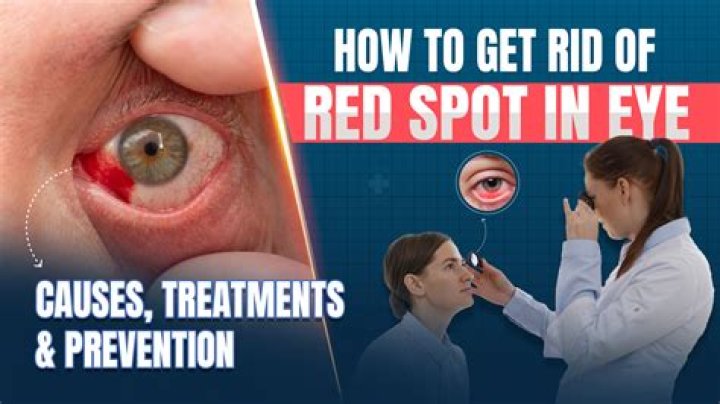 Effective Solutions for Red Pimples Under the Eyes: Causes, Treatments, and Prevention