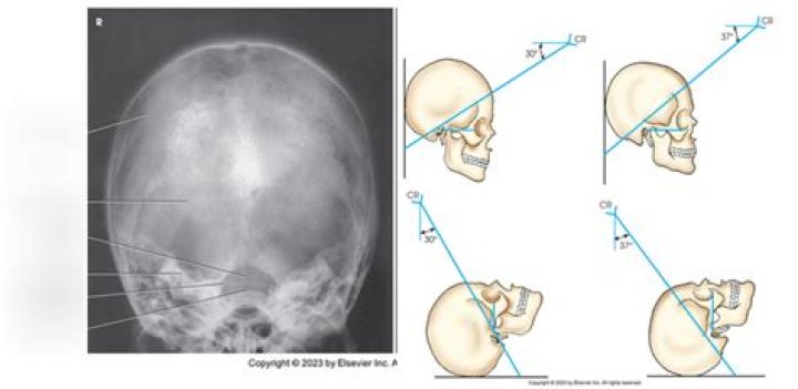 Exploring the Life and Career of Jocelyn Towne: A Comprehensive Insight