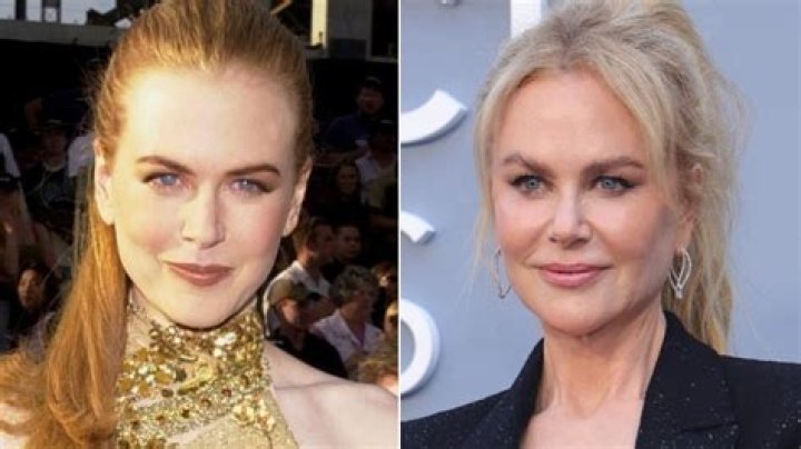 Has Nicole Kidman Had Plastic Surgery? A Comprehensive Look