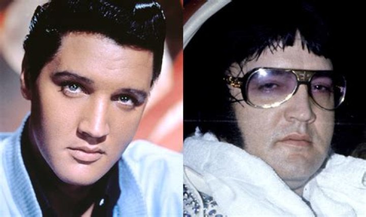 How Did Elvis Die: The Truth Behind the King's Tragic End