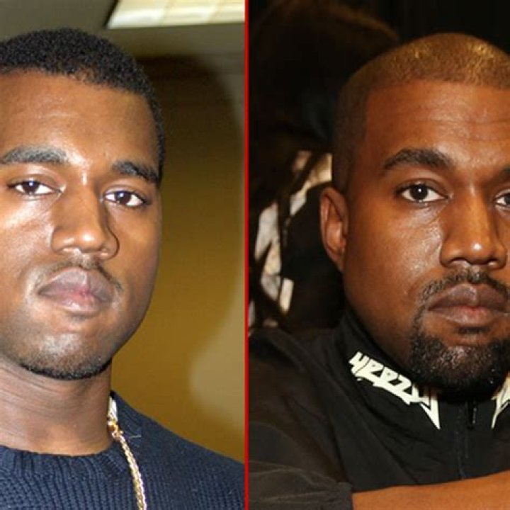 Kanye Before and After: A Detailed Exploration of His Journey