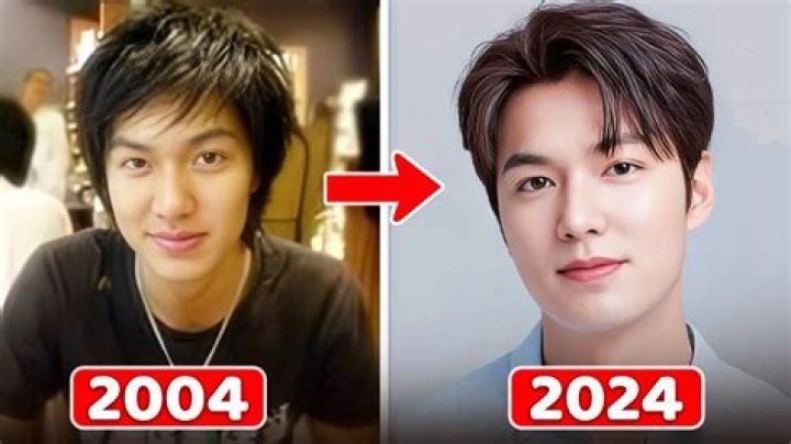 Kim Soo Hyun Plastic Surgery: Truth Behind the Transformation