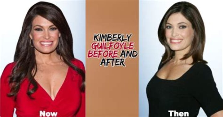 Kimberly Guilfoyle Before and After: A Comprehensive Look at Her Transformation