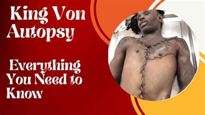 King Von Autopsy Video: Unveiling the Truth and Impact