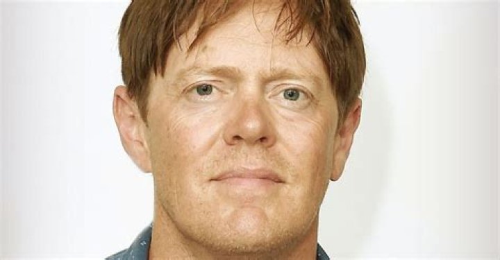Kris Marshall Face Surgery: A Comprehensive Guide to Understanding the Procedure
