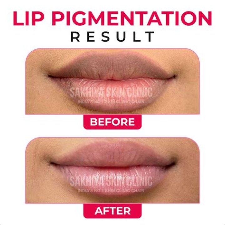 Lips NYC: The Ultimate Destination for Lip Care and Aesthetics