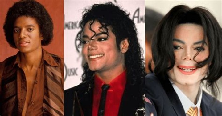 Michael Jackson with Vitiligo: A Comprehensive Exploration