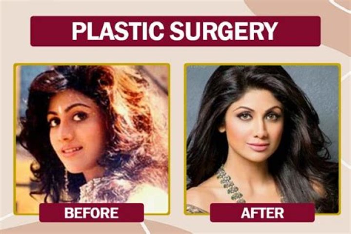 Ms. Sethi Before Surgery: A Comprehensive Insight