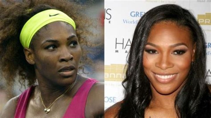 Serena Williams Plastic Surgery: The Truth Behind the Transformations
