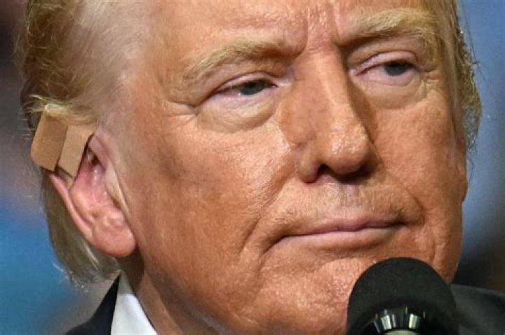 Trump Ear Without Bandage: Understanding the Controversy and Its Impact