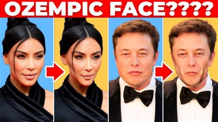 What Celebrities Take Ozempic: A Comprehensive Guide