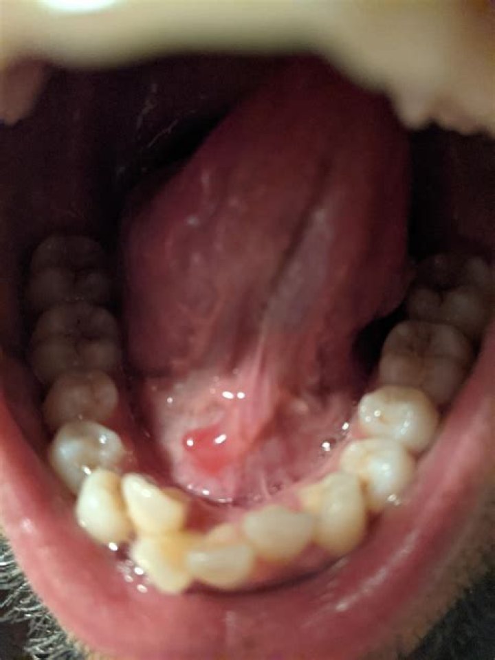 What Does Salt Under Your Tongue Do? Discover the Surprising Benefits