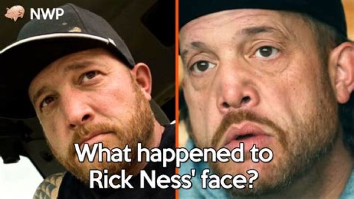 What Happened to Rick Ness Face: Unraveling the Mystery Behind the Controversy