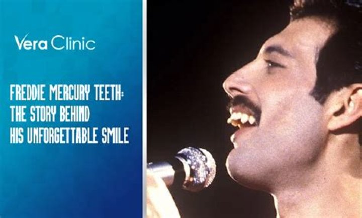 What Was Wrong with Freddie Mercury's Teeth: Unveiling the Truth Behind the Iconic Smile